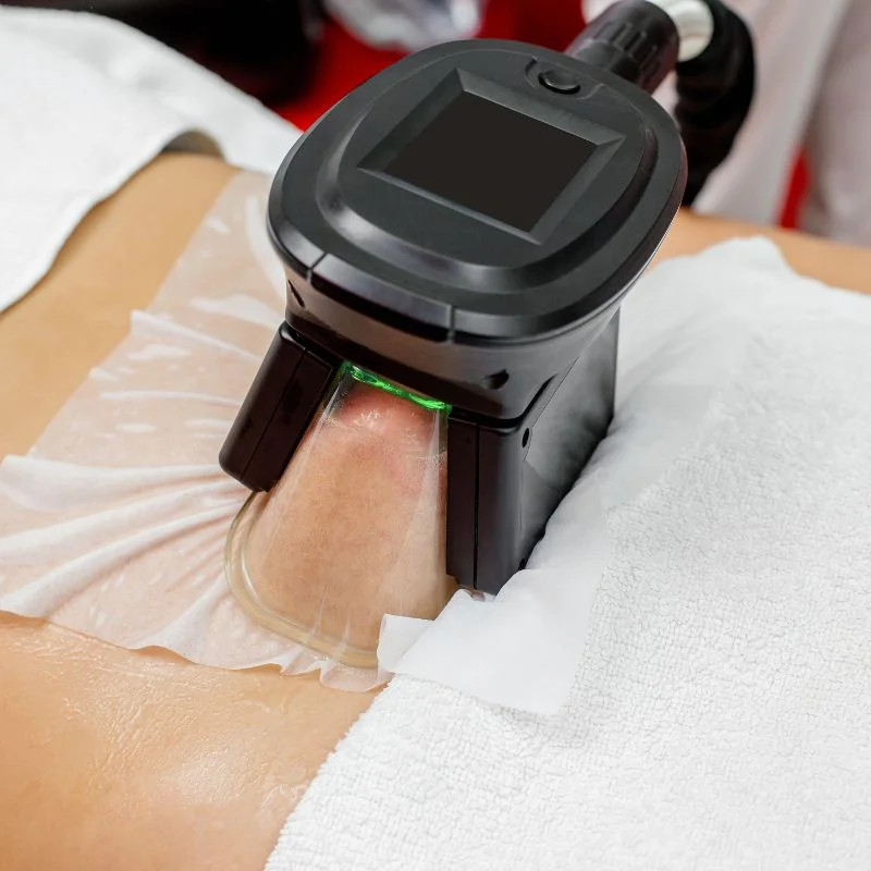 Fat Freezing treatment Stourbridge